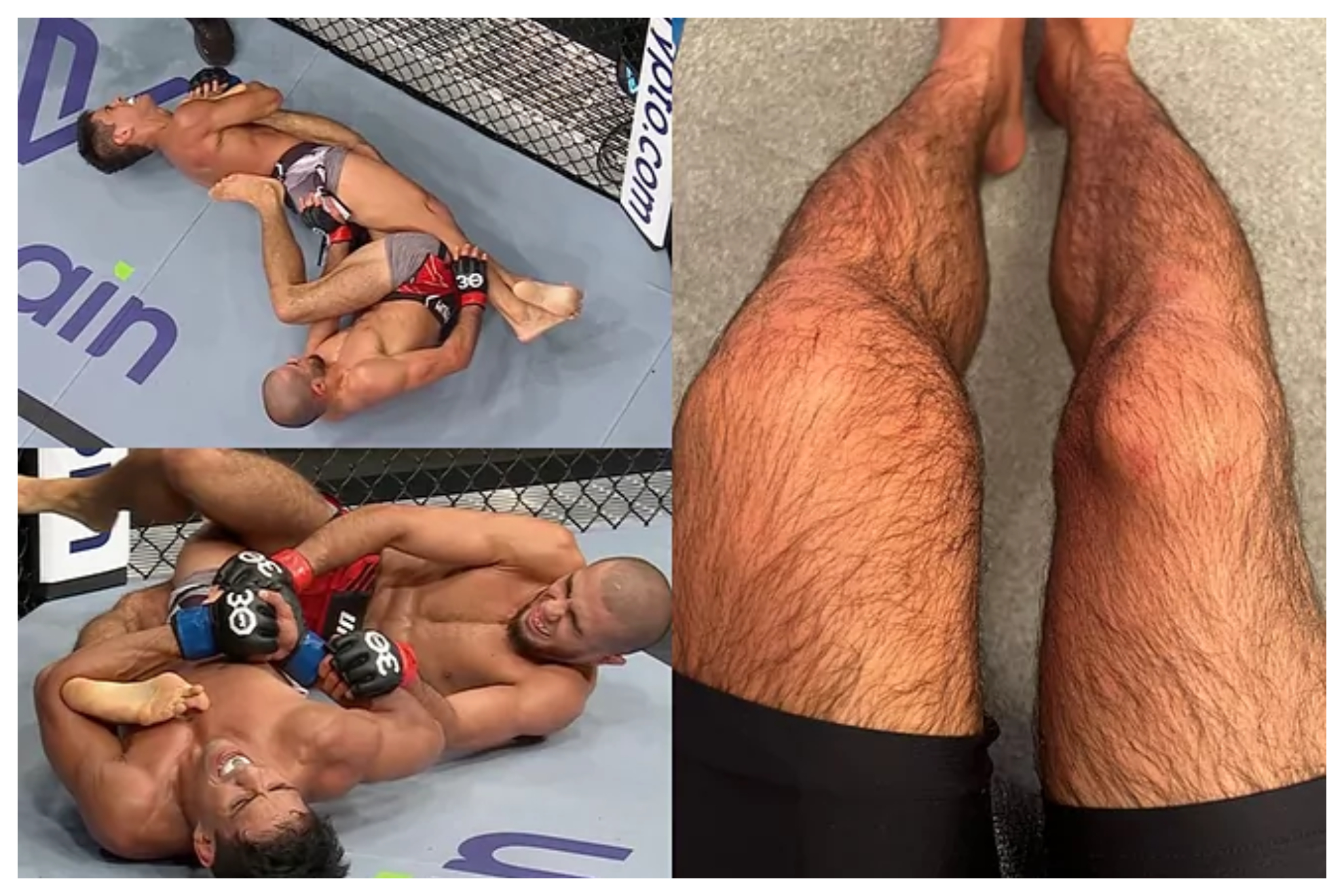 Milagro en la UFC: Mokaev se destroza la rodilla en una llave brutal... y gana