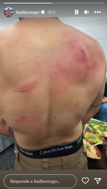 WWE: Bad Bunny quedó con la espalda destrozada tras su dura pelea con Damian Priest en BackLash