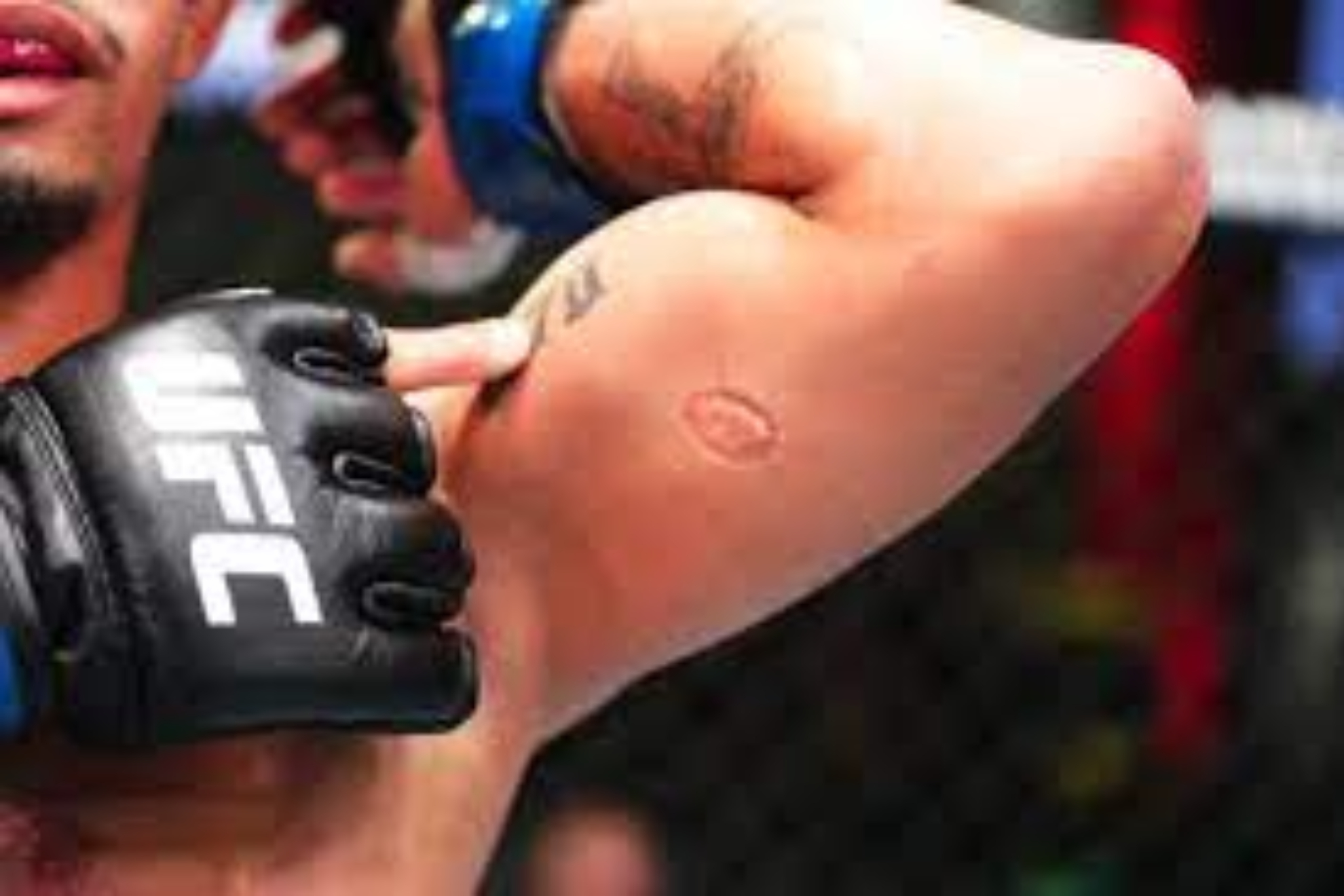 Andre Lima es mordido por Igor Severino en combate de UFC Vegas 89 y se tata la marca de los dientes
