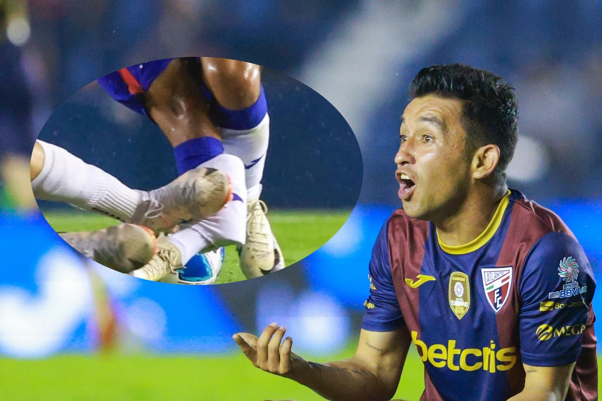 Acusan a Luis Ruz de lesionar a otro jugador antes del Hobbit Bermdez en el Atlante vs Dorados