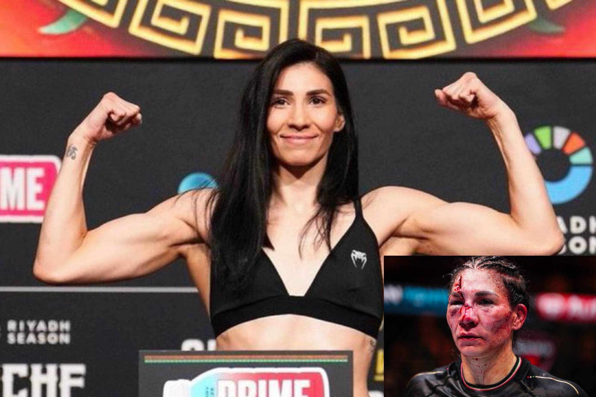 La terrible lesin que sufri Irene Aldana en UFC 306